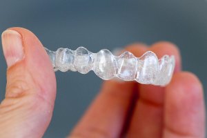 Invisalign tray close up